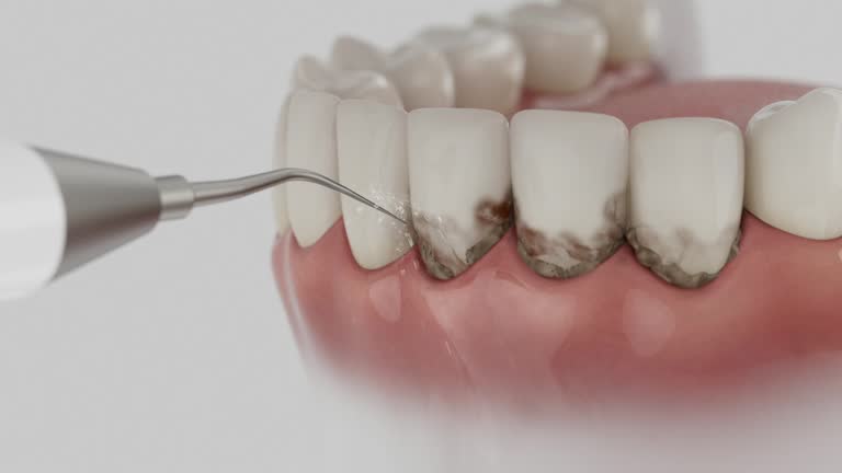 Trusted Teeth Cleaning And Checkup service in Jackson, WI - Dentist Open Now